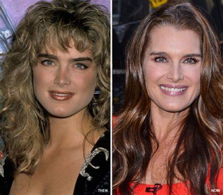 Brooke Shields Nose Job