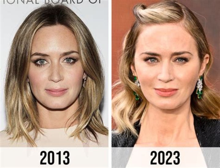 Here The Real Reason Why Emily Compagno Got Plastic Surgery