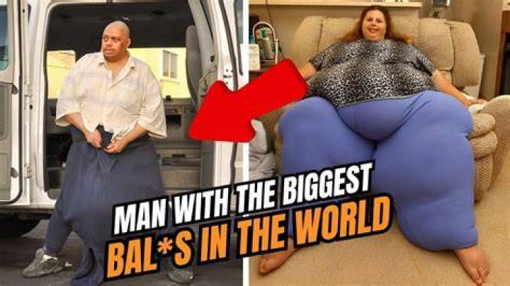 Who has the biggest scrotum?